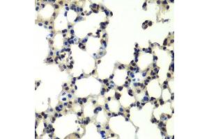 Immunohistochemistry of paraffin-embedded mouse lung using PSMD13 antibody. (PSMD13 抗体  (AA 1-250))