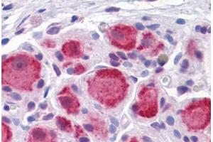 Human Ganglion cells: Formalin-Fixed, Paraffin-Embedded (FFPE) (DARS 抗体  (AA 393-501))