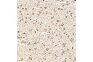 Immunohistochemistry (Paraffin-embedded Sections) (IHC (p)) image for anti-NSFL1 (p97) Cofactor (p47) (NSFL1C) antibody (ABIN7074865)