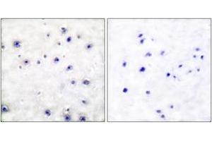 Immunohistochemistry analysis of paraffin-embedded human brain tissue, using Trk A (Ab-791) Antibody. (TRKA 抗体  (AA 747-796))