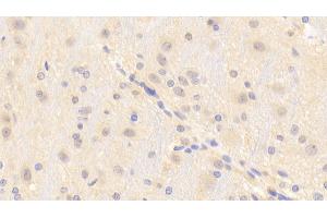 Immunohistochemistry (IHC) image for anti-Transient Receptor Potential Cation Channel, Subfamily M, Member 7 (TRPM7) (AA 19-179) antibody (ABIN7436144)