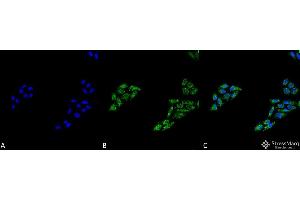 Immunocytochemistry/Immunofluorescence analysis using Rabbit Anti-p53 Polyclonal Antibody . (p53 抗体  (C-Term) (PerCP))