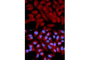 Immunofluorescence analysis of U2OS cells using EIF5A antibody. (EIF5A 抗体)