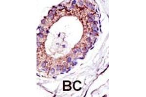 Immunohistochemistry (IHC) image for anti-Ubiquitination Factor E4A (UBE4A) antibody (ABIN3001447) (UBE4A 抗体)
