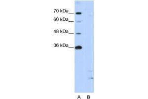 Western Blotting (WB) image for anti-Peptidylprolyl Isomerase E (Cyclophilin E) (PPIE) antibody (ABIN2462198) (PPIE 抗体)
