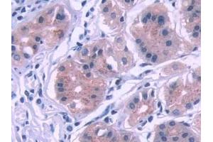 Detection of KEAP1 in Human Stomach Tissue using Polyclonal Antibody to Kelch Like ECH Associated Protein 1 (KEAP1) (KEAP1 抗体  (AA 327-624))