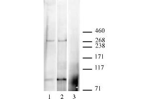 CABIN1 antibody (pAb) tested by Immunoprecipitation / Western blot. (CABIN1 抗体  (C-Term))