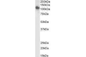Western Blotting (WB) image for anti-Solute Carrier Family 12 (Potassium-Chloride Transporter) Member 6 (SLC12A6) (Internal Region) antibody (Biotin) (ABIN5539775)