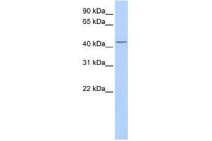 TRABD antibody used at 1 ug/ml to detect target protein. (TRABD 抗体  (Middle Region))