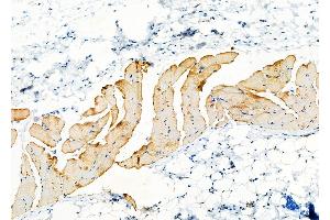ABIN6261220 and ABIN6277828 at 1/100 staining Rat skin tissue by IHC-P.