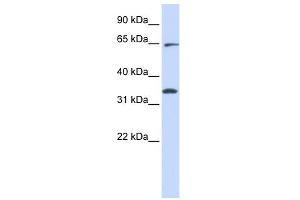 RHOT1 antibody used at 1 ug/ml to detect target protein. (RHOT1 抗体  (Middle Region))