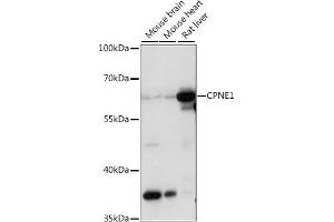 Western blot analysis of extracts of various cell lines, using CPNE1 antibody (ABIN7266499) at 1:1000 dilution. (CPNE1 抗体  (AA 120-220))