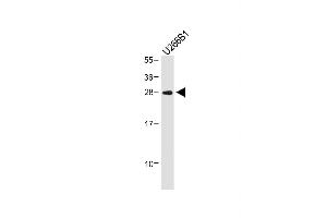 Anti-IGLL5 Antibody (C-term) at 1:1000 dilution + U266B1 whole cell lysate Lysates/proteins at 20 μg per lane. (IGLL5 抗体  (C-Term))