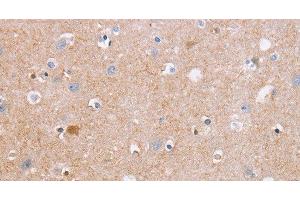 Immunohistochemistry of paraffin-embedded Human brain tissue using CDC7 Polyclonal Antibody at dilution 1:50 (CDC7 抗体)