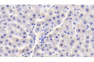 Detection of vHL in Rat Liver Tissue using Polyclonal Antibody to Von Hippel Lindau Tumor Suppressor (vHL) (VHL 抗体  (AA 6-175))