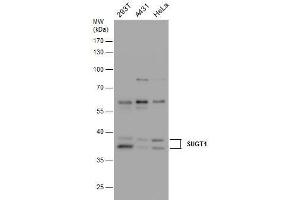 WB Image SUGT1 antibody detects SUGT1 protein by western blot analysis. (SUGT1 抗体  (Center))