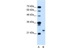 WB Suggested Anti-MOSPD3 Antibody Titration:  5. (MOSPD3 抗体  (C-Term))