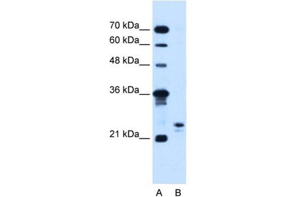MOSPD3 抗体  (C-Term)