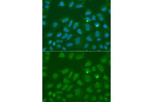 Immunofluorescence analysis of A549 cells using ORC6 antibody (ABIN6293429). (ORC6 抗体)