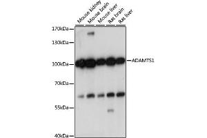 Western blot analysis of extracts of various cell lines, using  antibody (ABIN7265439) at 1:1000 dilution. (ADAMTS1 抗体  (AA 718-967))