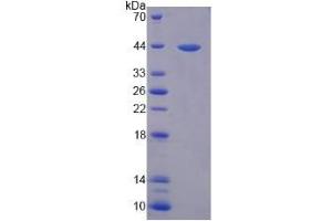 SDS-PAGE analysis of Mouse Interleukin 33 Protein. (IL-33 蛋白)