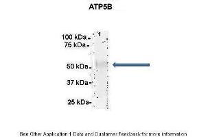 Immunoprecipitation (IP) image for anti-ATP Synthase, H+ Transporting, Mitochondrial F1 Complex, beta Polypeptide (ATP5B) (C-Term) antibody (ABIN2783269)