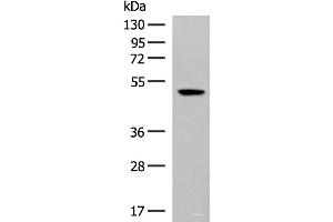 Western blot analysis of Hela cell lysate using GPR142 Polyclonal Antibody at dilution of 1:400 (GPR142 抗体)