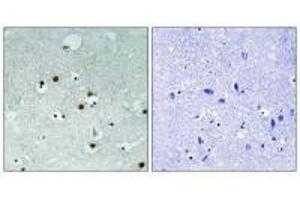 Immunohistochemistry analysis of paraffin-embedded human braina tissue using HP1 alpha (Ab-92) antibody. (CBX5 抗体  (Ser92))