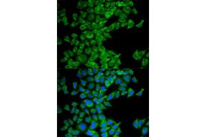 Immunofluorescence analysis of MCF-7 cell using DIABLO antibody. (DIABLO 抗体  (AA 1-232))