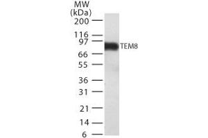 Image no. 1 for anti-anthrax Toxin Receptor 1 (ANTXR1) (AA 481-497) antibody (ABIN208216) (ANTXR1 抗体  (AA 481-497))