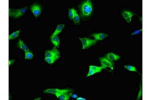 Immunofluorescent analysis of Hela cells using ABIN7160855 at dilution of 1:100 and Alexa Fluor 488-congugated AffiniPure Goat Anti-Rabbit IgG(H+L) (SIRT2 抗体  (AA 177-279))