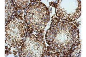 Immunohistochemistry (IHC) image for anti-Potassium Voltage-Gated Channel, Subfamily G, Member 4 (Kcng4) (Center) antibody (ABIN2856250)