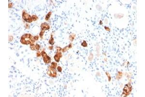 Formalin-fixed, paraffin-embedded human Kidney stained with Calbindin 1 Mouse Monoclonal Antibody (CALB1/2782). (CALB1 抗体  (AA 7-96))