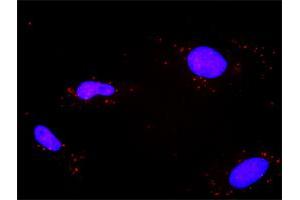 Proximity Ligation Analysis of protein-protein interactions between TP53 and PPP2R1A.
