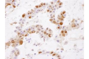 Immunohistochemistry (IHC) image for anti-Glutathione S-Transferase pi 1 (GSTP1) (AA 160-210) antibody (ABIN7453941) (GSTP1 抗体  (AA 160-210))