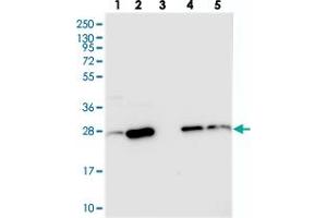 Western blot analysis of Lane 1: RT-4, Lane 2: U-251 MG, Lane 3: Human Plasma, Lane 4: Liver, Lane 5: Tonsil with CRIP2 polyclonal antibody  at 1:250-1:500 dilution. (CRIP2 抗体)