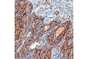 Immunohistochemistry of paraffin-embedded rat ovary using PRKB Rabbit mAb (ABIN7269663) at dilution of 1:100 (40x lens). (PRKAR2B 抗体)