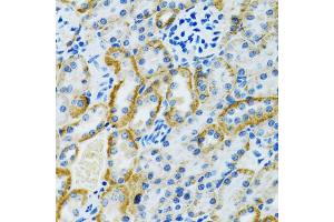 Immunohistochemistry of paraffin-embedded rat kidney using GDAP1 antibody (ABIN5973967) at dilution of 1/100 (40x lens). (GDAP1 抗体)
