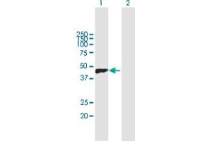 Western Blot analysis of VCAN expression in transfected 293T cell line by VCAN MaxPab polyclonal antibody. (Versican 抗体  (AA 1-354))