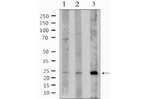 Western blot analysis of extracts from various samples, using BNIP3L Antibody. (BNIP3L/NIX 抗体  (Internal Region))