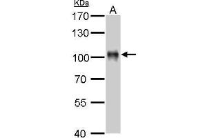 WB Image Villin antibody detects VIL1 protein by Western blot analysis.
