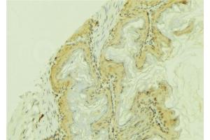 ABIN6273744 at 1/100 staining Mouse colon tissue by IHC-P. (CYP4F12 抗体)