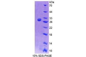 SDS-PAGE analysis of Mouse TCEA2 Protein. (TCEA2 蛋白)