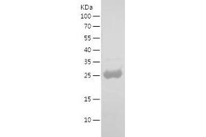 Western Blotting (WB) image for p24 (AA 133-363) protein (His tag) (ABIN7124294) (p24 (AA 133-363) protein (His tag))
