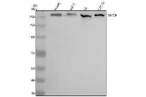 Western blot analysis of MYOF using anti-MYOF antibody (ABIN7825563).
