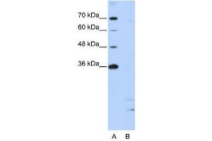 WB Suggested Anti-PPIE  Antibody Titration: 2. (PPIE 抗体  (Middle Region))
