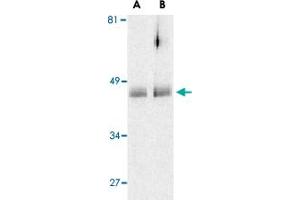 Western blot analysis of HTRA2 in human colon cell lysates with HTRA2 polyclonal antibody  at (A) 0. (HTRA2 抗体  (C-Term))