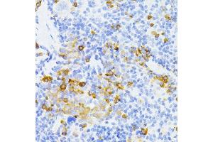 Immunohistochemistry of paraffin-embedded mouse spleen using MMP2 antibody. (MMP2 抗体  (AA 40-280))