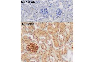 Immunohistochemistry (IHC) image for anti-CD5 (CD5) (AA 105-210) antibody (ABIN7272988)