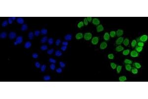 IF analysis of FEN1 using anti-FEN1 antibody (ABIN7601618).